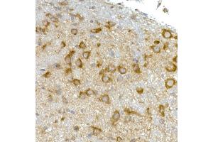 Immunohistochemistry of paraffin-embedded mouse brain using RPL13 Rabbit mAb (ABIN7269993) at dilution of 1:50 (40x lens). (RPL13 antibody)