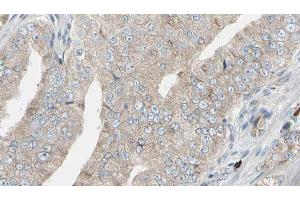 ABIN6272945 at 1/100 staining Human prostate tissue by IHC-P.