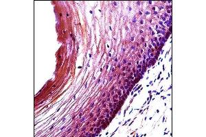 BBC3 Antibody (Center) (ABIN658021 and ABIN2850502) immunohistochemistry analysis in formalin fixed and paraffin embedded human cervix tissue followed by peroxidase conjugation of the secondary antibody and DAB staining. (PUMA antibody  (AA 109-137))