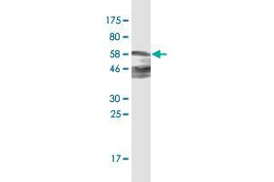 Western Blot detection against Immunogen (61. (ZNF187 antibody  (AA 1-325))