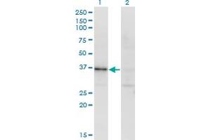 Western Blot analysis of RBKS expression in transfected 293T cell line by RBKS monoclonal antibody (M01), clone 3B4. (Ribokinase antibody  (AA 1-322))