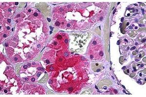Human Kidney, Tubules: Formalin-Fixed, Paraffin-Embedded (FFPE) (GALT antibody  (AA 1-380))
