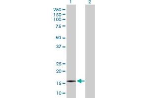 Western Blot analysis of CXCL5 expression in transfected 293T cell line by CXCL5 MaxPab polyclonal antibody. (CXCL5 antibody  (AA 1-114))