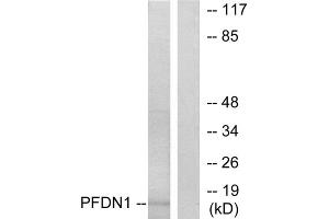 Western blot analysis of extracts from RAW264. (PFDN1 antibody  (N-Term))