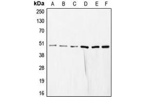 Western blot analysis of COPS3 expression in HeLa (A), SP2/0 (B), mouse liver (C), rat liver (D), NIH3T3 (E), HEK293T (F) whole cell lysates. (COPS3 antibody  (Center))