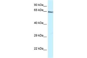 WB Suggested Anti-Gatad2b Antibody Titration: 1.