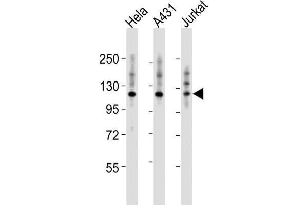 ITGA7 antibody  (N-Term)