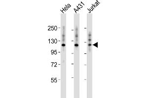 All lanes : Anti-ITGA7 Antibody (N-term) at 1:2000 dilution Lane 1: Hela whole cell lysates Lane 2: A431 whole cell lysates Lane 3: Jurkat whole cell lysates Lysates/proteins at 20 μg per lane.