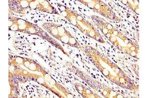 IHC image of ABIN7167935 diluted at 1:200 and staining in paraffin-embedded human small intestine tissue performed on a Leica BondTM system. (ARHGAP18 antibody  (AA 389-577))