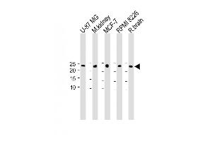 All lanes : Anti-C9orf95 Antibody (N-term) at 1:1000 dilution Lane 1: U-87 MG whole cell lysate Lane 2: M.
