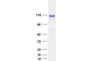 Validation with Western Blot (ABCG1 Protein (Transcript Variant 2) (Myc-DYKDDDDK Tag))