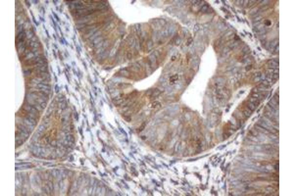 ILVBL antibody