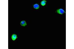 Immunofluorescent analysis of Hela cells using ABIN7151266 at dilution of 1:100 and Alexa Fluor 488-congugated AffiniPure Goat Anti-Rabbit IgG(H+L) (TRIM37 antibody  (AA 301-600))