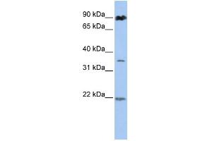 WB Suggested Anti-C13orf7 Antibody Titration:  0. (RNF219 antibody  (N-Term))