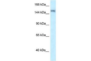 WB Suggested Anti-LRRK1 Antibody Titration: 1. (LRRK1 antibody  (N-Term))