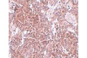 Immunohistochemistry of TSPAN9 in human spleen tissue with this product at 2. (Tetraspanin 9 antibody  (Center))