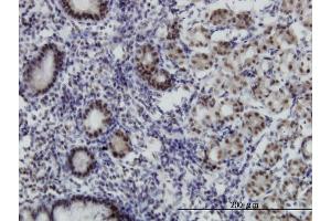 Immunoperoxidase of monoclonal antibody to MGC21874 on formalin-fixed paraffin-embedded human stomach. (TADA2B antibody  (AA 2-110))