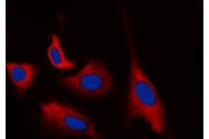 Immunofluorescent analysis of CDK5 (pY15) staining in HEK293T cells. (CDK5 antibody  (N-Term, pTyr15))