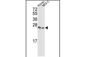 Western blot analysis of hYWHAZ- (ABIN392782 and ABIN2842219) in mouse brain tissue and MCF-7 cell line lysates (35 μg/lane). (14-3-3 zeta antibody  (AA 216-245))