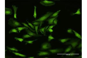 Immunofluorescence of purified MaxPab antibody to NLRP2 on HeLa cell. (NLRP2 antibody  (AA 1-1062))