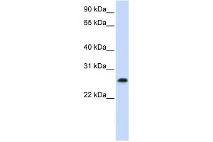 WB Suggested Anti-PHF19 Antibody Titration:  0. (PHF19 antibody  (C-Term))