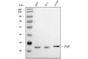 Western blot analysis of PNP using anti-PNP antibody (ABIN4886701). (PNP antibody  (Middle Region))