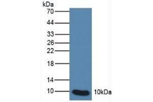 Detection of S100P in Human Leukocyte Cells using Polyclonal Antibody to S100 Calcium Binding Protein P (S100P) (S100P antibody  (AA 1-95))