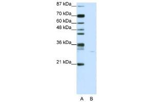 SGK1 antibody used at 1 ug/ml to detect target protein. (SGK1 antibody  (N-Term))
