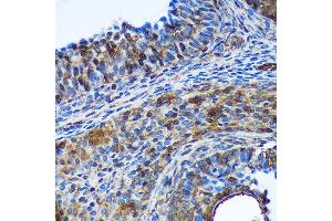 Immunohistochemistry of paraffin-embedded Rat ovary using TSN Rabbit pAb  at dilution of 1:100 (40x lens). (Translin antibody  (AA 50-150))
