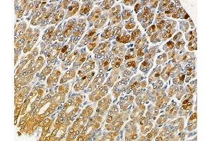 ABIN6262285 and ABIN6279484 at 1/100 staining mouse muscle tissue by IHC-P.