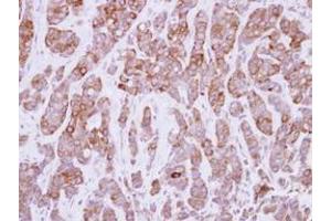 Image no. 2 for anti-Calpastatin (CAST) (AA 275-700) antibody (ABIN1497106) (Calpastatin antibody  (AA 275-700))