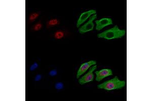 ABIN7093308 and ABIN7097327 staining Hela cells by IF/ICC. (CHEK2 antibody  (C-Term))