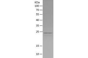 PAX8 Protein (AA 243-450) (His tag)