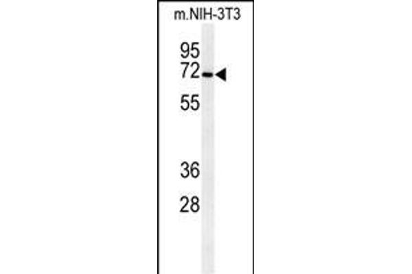 CSGALNACT1 anticorps  (AA 192-220)
