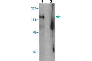 Western blot analysis of SGSM2 in human cerebellum tissue with SGSM2 polyclonal antibody  at 1 ug/mL in (1) the absence and (2) the presence of blocking peptide.