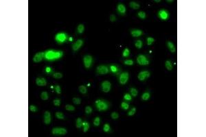 Immunofluorescence analysis of U2OS cells using PMS2 Polyclonal Antibody (PMS2 antibody)