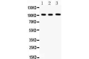 Anti- ITCH Picoband antibody, Western blotting All lanes: Anti ITCH  at 0. (ITCH antibody  (Middle Region))