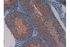 IHC-P analysis of Mouse Testis Tissue, with DAB staining. (TFAM antibody  (AA 43-243))