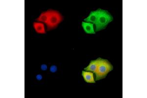 ABIN6263481 and ABIN6279564 staining Hela cells by IF/ICC.