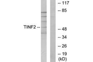 Western blot analysis of extracts from HuvEc cells, using TINF2 Antibody. (TINF2 antibody  (AA 71-120))