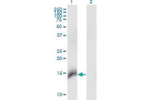 Western Blot analysis of CBY1 expression in transfected 293T cell line by CBY1 monoclonal antibody (M06), clone 2F2.