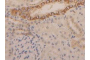 DAB staining on IHC-P; Samples: Rat Kidney Tissue (Cytokeratin 1 antibody  (AA 350-488))
