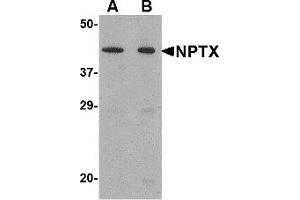 Western Blotting (WB) image for anti-Neuronal Pentraxin II (NPTX2) (Middle Region) antibody (ABIN1031027) (NPTX2 antibody  (Middle Region))