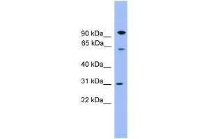 WB Suggested Anti-CPNE6 Antibody Titration: 0. (CPNE6 antibody  (Middle Region))