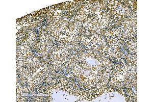 IHC analysis of Ezrin/EZR using anti-Ezrin/EZR antibody (ABIN7603214).