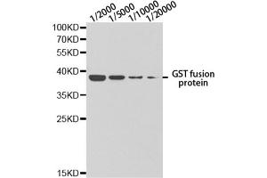 Western blot analysis of GST-tagged protein using GST antibody at different dilution. (GST-Tag antibody)