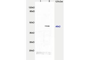 L1 rat brain, L2 human colon carcinoma lysates probed  at 1:200 in 4˚C. (TWIST1, TWIST2 (AA 71-170) antibody)