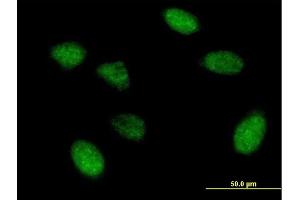 Immunofluorescence of purified MaxPab antibody to EIF5A2 on HeLa cell.