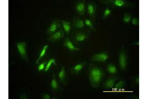 Image no. 4 for anti-serine/threonine Kinase 4 (STK4) (AA 1-40) antibody (ABIN598949) (STK4 antibody  (AA 1-40))