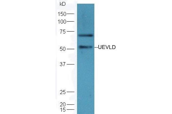 UEVLD Antikörper  (AA 85-180)